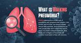 Is It a Common Cold or Walking Pneumonia? Identify Symptoms and Know H