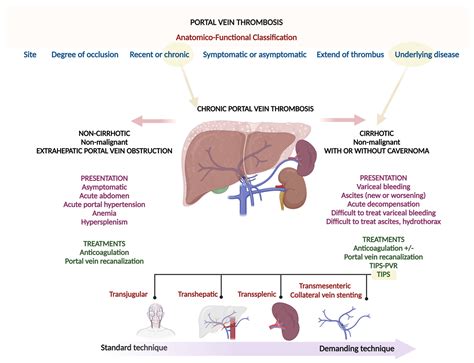 Transjugular Intrahepatic Portosystemic Shunt in Chronic Portal Vein Thrombosis—From Routine ...