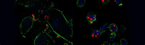 Home - INDIAN ACADEMY OF MEDICAL GENETICS(IAMG)