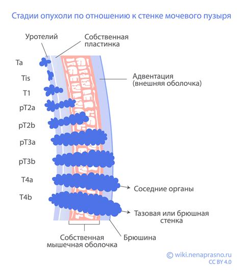 Онко Вики - Как устроен и как работает мочевой пузырь