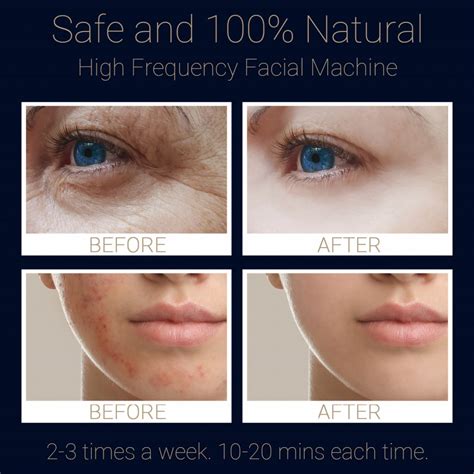 How To Use High Frequency Face Wand at Daniel Mcbryde blog