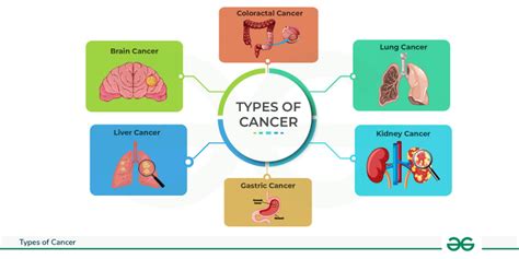 Types of Cancer Names 的图像结果