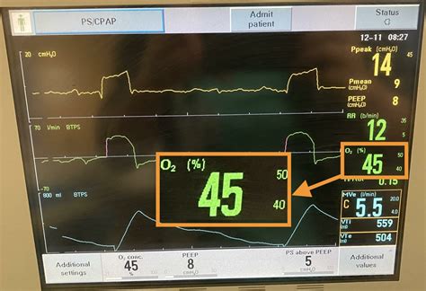 Image result for FiO2 2 LNC