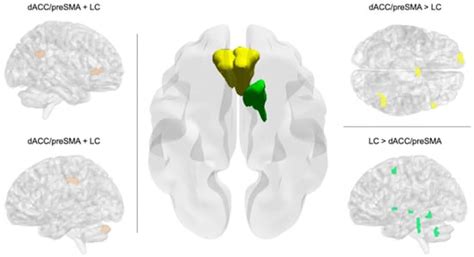 The Neurodevelopmental Dynamics of Multilingual Experience During ...
