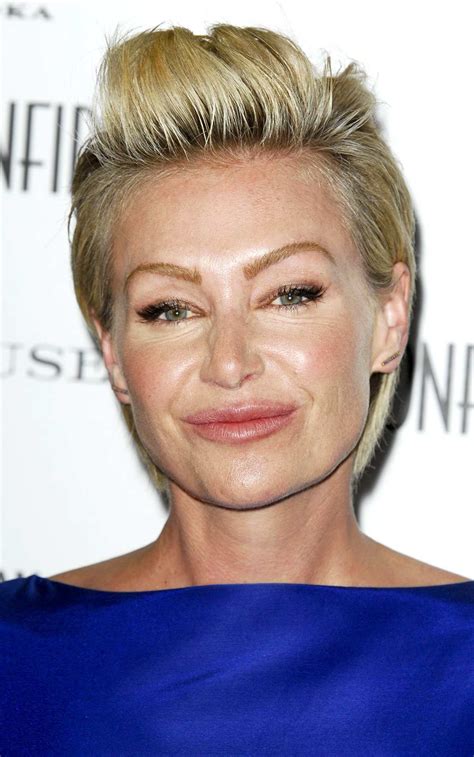 Portia De Rossi Face Surgery