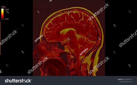 High Res Brain Scan Image 的图像结果