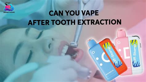 How To Safely Vape After Tooth Extraction A Complete Guide To Healing Six Crucial Rules For Vaping After Oral Surgery First Three Days Of Vaping Post Tooth Extraction Everything You Need To Know About Vaping And Healing