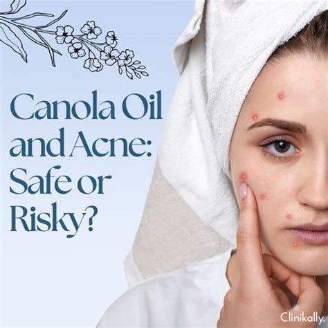 Canola Oil for Skin: What Dermatologists Want You to Know | Clinikally
