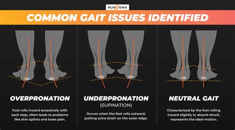Gait Analysis for Running Shoes – Making You a Better Runner