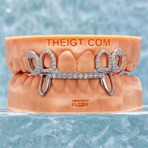 Women's Custom Grillz | Dainty Moissanite, Rose Gold & Opal | IGT ...