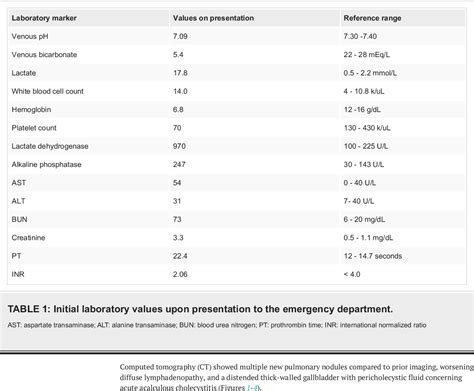 Table 1 from Unveiling of Type B Lactic Acidosis From Systemic Lupus Erythematosus-Associated B ...