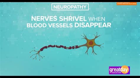 Sponsored: Live a pain free life by reversing Neuropathy | khou.com