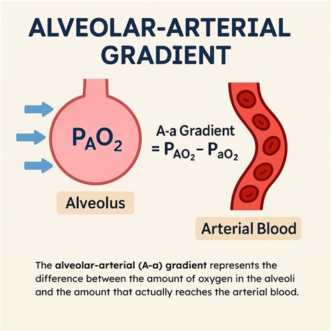 Alveolar-Arterial Gradient (A-a): Overview and Calculation