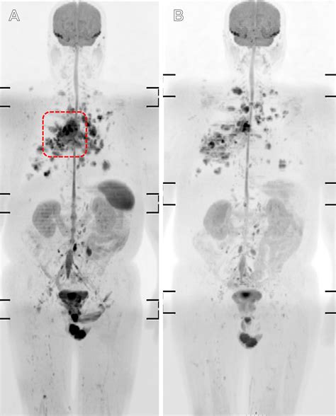 Future Of Precision Radiation Imaging – VYJSBI