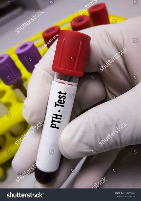 Blood Work Tests Pth at Raymond Trombly blog