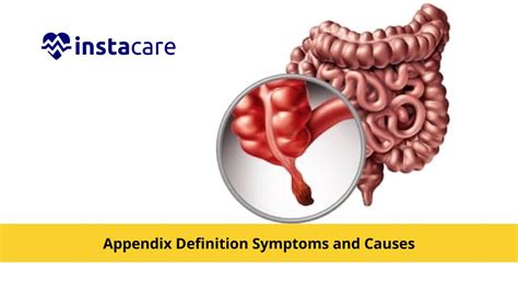 Image result for Appendix Example Website