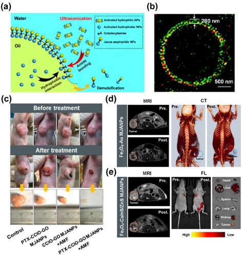 Design of Magnetic Nanoplatforms for Cancer Theranostics