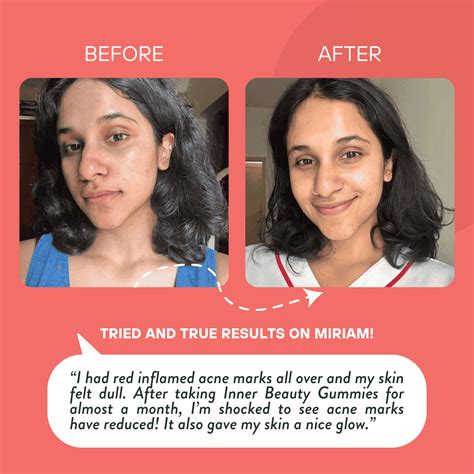 Gummy for Better Hair & Skin | Beauty Gummies - Sova Health