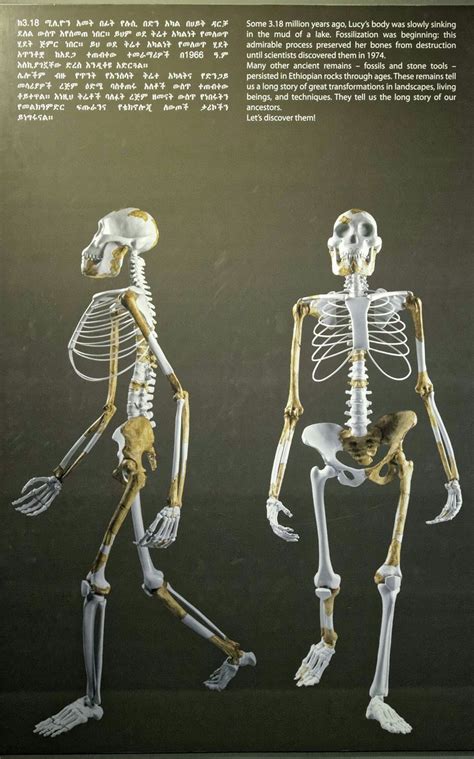 Image result for Skeleton Brain Exploding