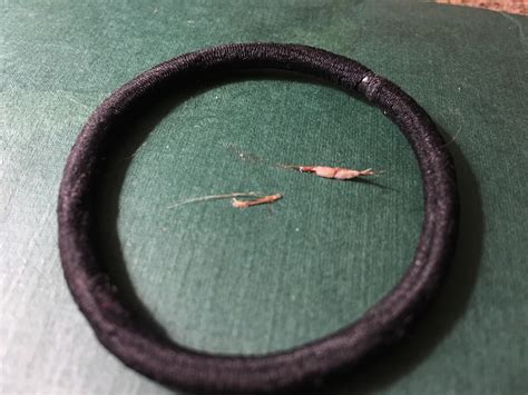 Popped a cyst in my belly button and pulled out these ingrown hairs (hair tie for scale) : r/popping