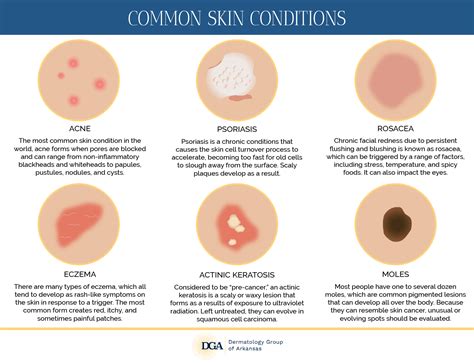 Common Skin Disorders Dermatology