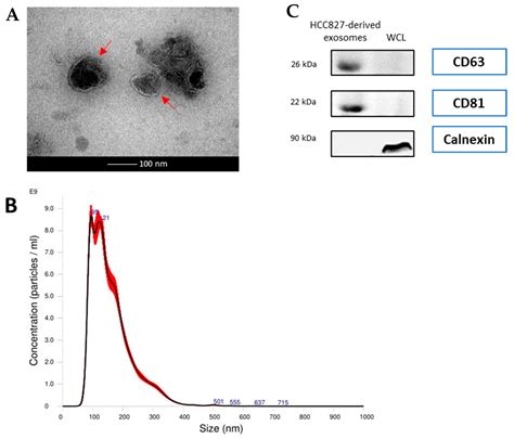 Exosomes from EGFR-Mutated Adenocarcinoma Induce a Hybrid EMT and MMP9 ...