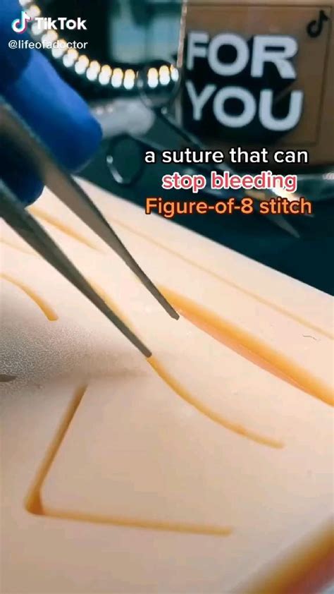 Image result for Common Suture Patterns