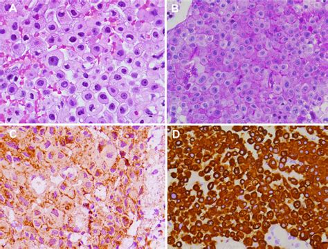 Image result for Solving Algorithm Analysis