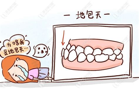 地包天牙齿正畸 整牙日记记录 牙齿矫正 二次矫正（终于要拆牙套了） - 知乎