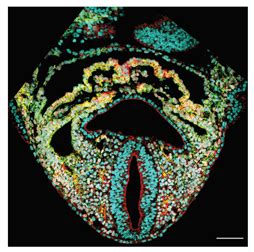 Imaging Approaches and the Quantitative Analysis of Heart Development
