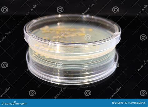 A Petri Dish with Common Yeast and Bacteria Colonies Stock Image ...