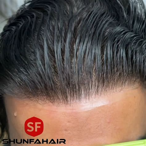 Shunfa Hair : r/HairSystem