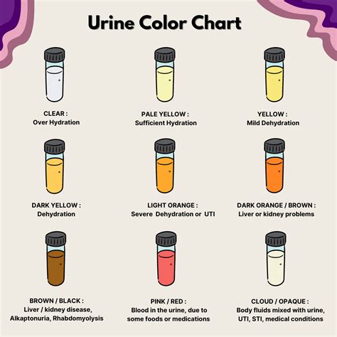 Urine Color During Pregnancy: Color Chart & What It Means