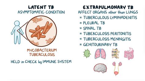 What Does Latent Tuberculosis Mean | The Tube
