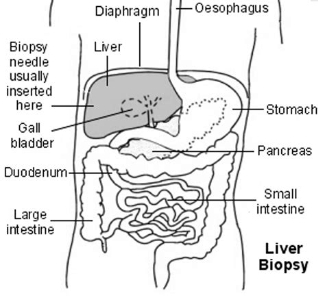 Liver Biopsy | What's the procedure and how is it done?