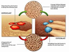 Image result for osteoclast 破骨细胞