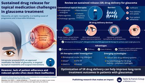 Glaucoma Eye Drop Charts Full Article: Sustained Release Glaucoma