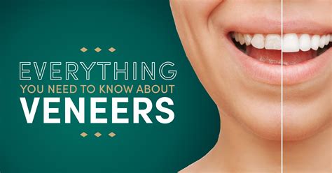 Everything You Need to Know About Veneers - Montrose Dental Wellness