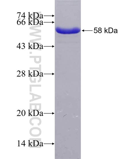EXOSC3 Fusion Protein Ag7065 | Proteintech