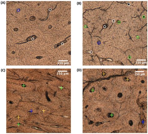 Osteonal Damage Patterns from Ballistic and Blunt Force Trauma in Human ...