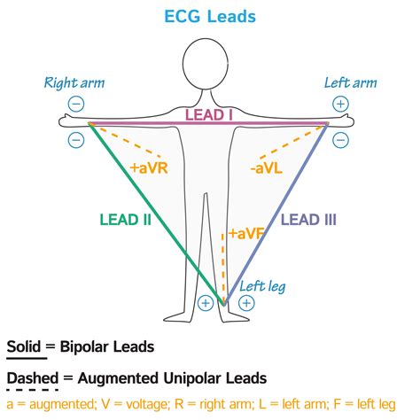 Physiology Glossary: Electrocardiogram (ECG) - Recordings and Leads | ditki medical & biological ...