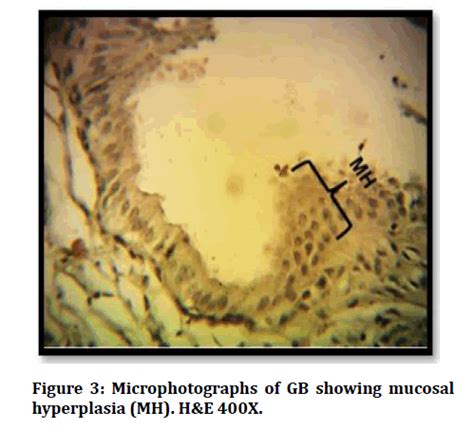 medical-dental-science-showing-mucosal