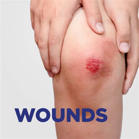 Buy Soframycin Multi-Purpose Antiseptic Cream for Cuts, Wounds, Burns ...