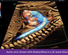 Image result for Fetal Heart Icon