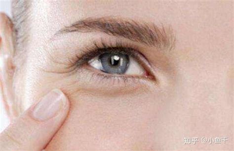 眼部干纹长什么样 怎么区分是干纹还是真的皱纹？ - 知乎