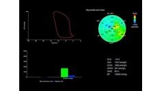 Cardiology Solutions | GE HealthCare (India)