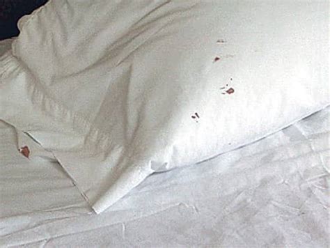 How Do You Know If Your Have Bed Bugs? 7 Tell Tale Signs