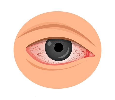Effective Tips for Reducing Digital Eye Strain
