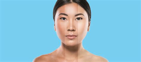 Can An Increase Or Decrease In Melanin Change Skin Color? – Re'equil