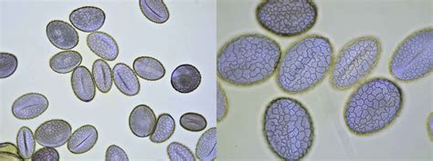 Pollen Under Microscope 40X at Deloris Colvin blog